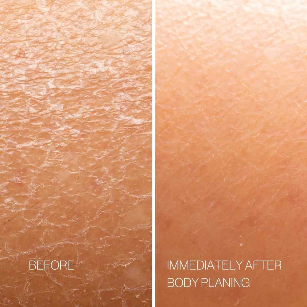 Body Plane Set - Esker